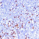 Formalin-fixed, paraffin embedded human tonsil sections stained with 100 ul anti-Kappa Light Chain (clone SPM508) at 1:50. HIER epitope retrieval prior to staining was performed in 10mM Citrate, pH 6.0.